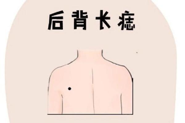 女人背部痣相图解算命