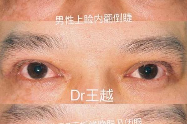 倒八字眼睛