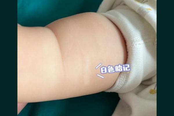 白色胎记算命分析
