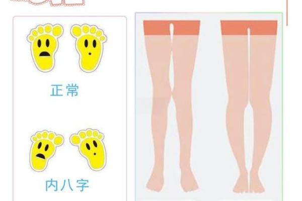 小孩走路内八字