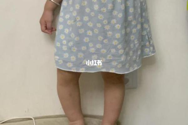 婴儿八字腿