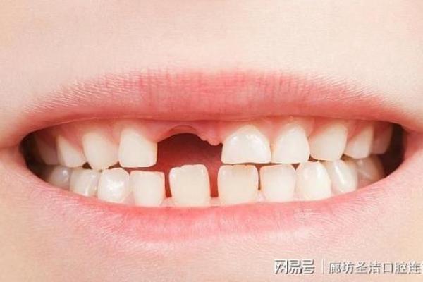 牙齿算命：牙齿的颜色看你的运势