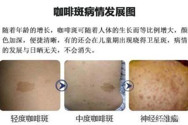 脸上胎记算命图解