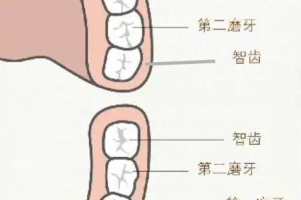 牙齿数量算命，牙齿算命图解