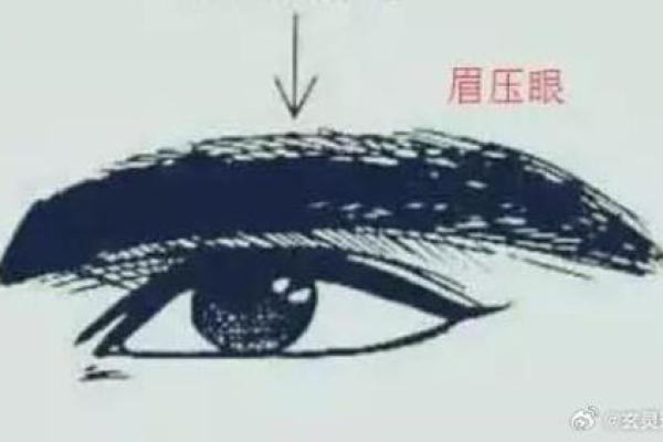 眼角八字
